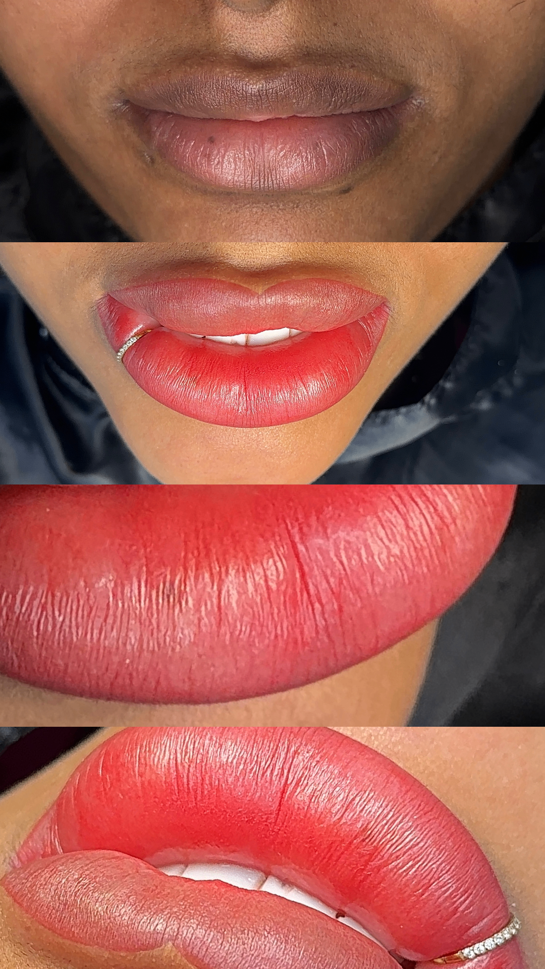 Resultado real de micropigmentação labial com o Método Velvety
