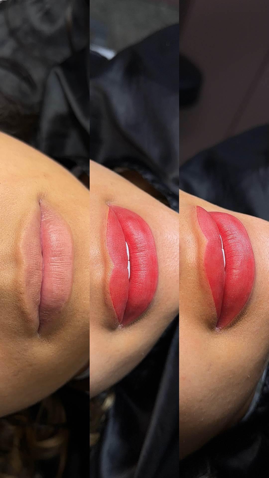 Resultado real de micropigmentação labial com o Método Velvety