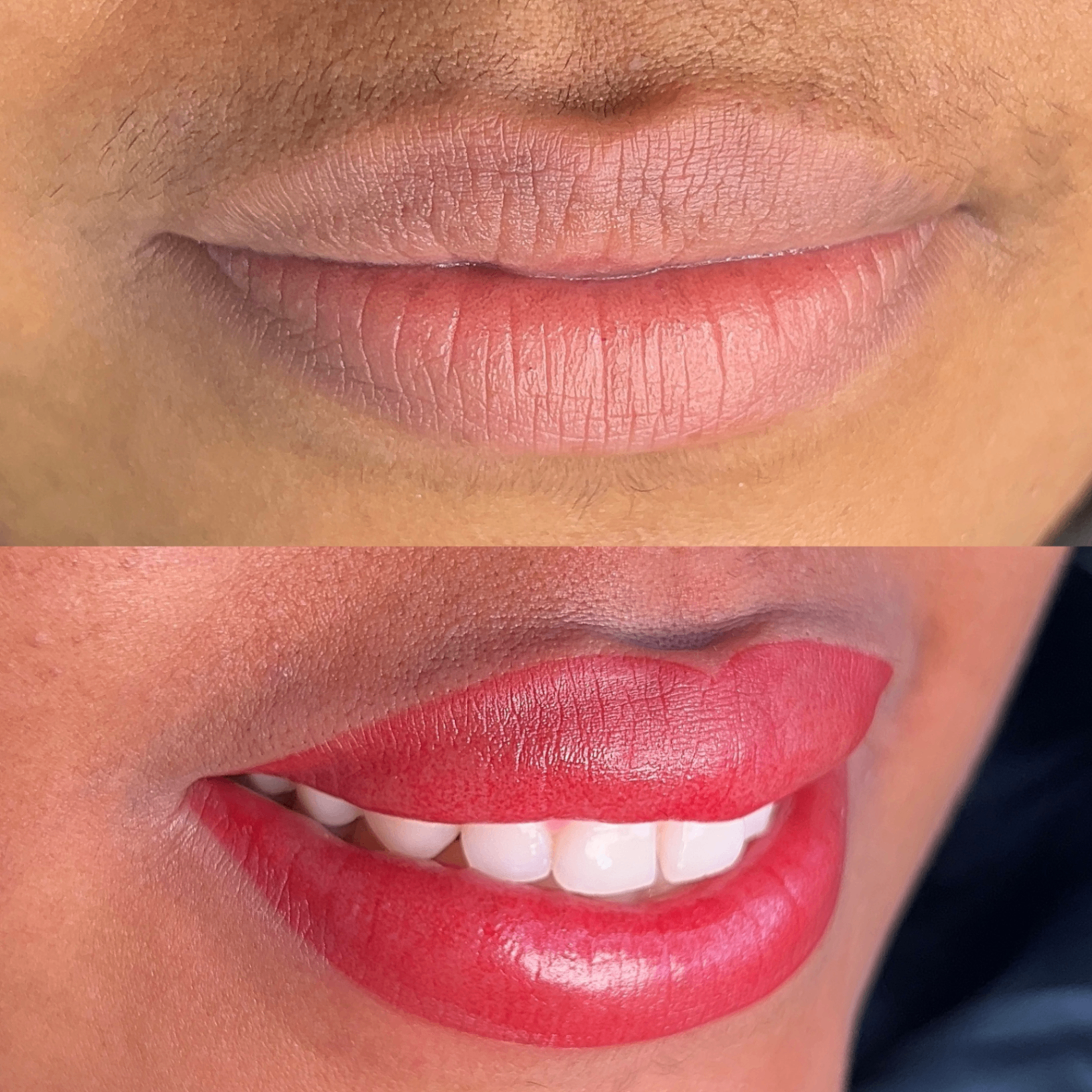 Resultado real de micropigmentação labial com o Método Velvety
