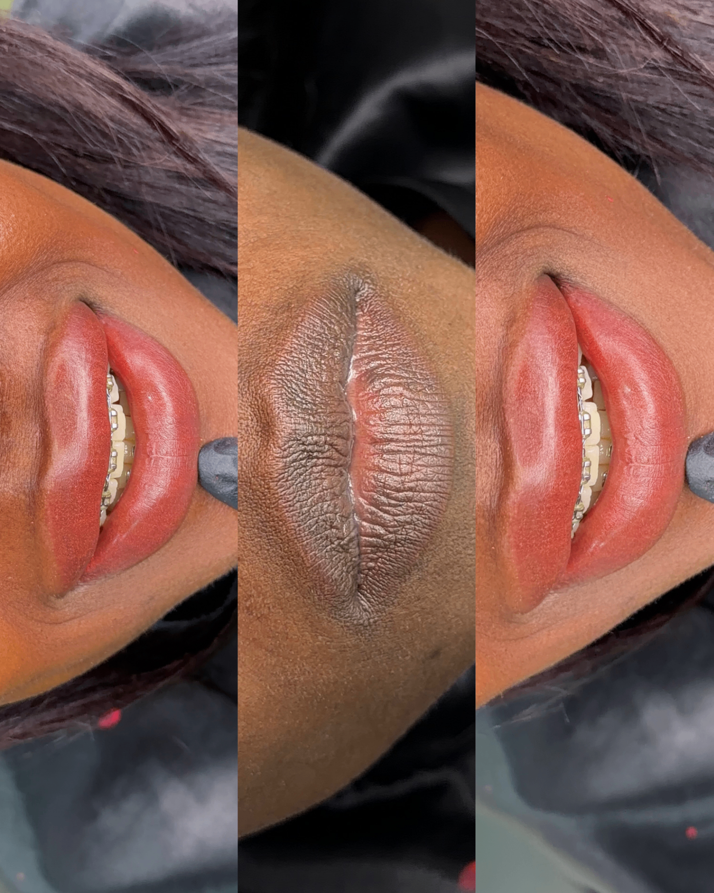 Resultado real de micropigmentação labial com o Método Velvety